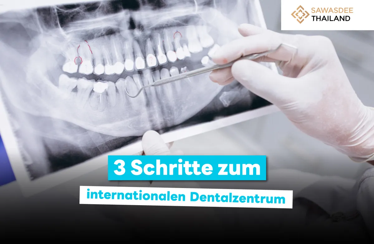 3 Schritte zum internationalen Dentalzentrum