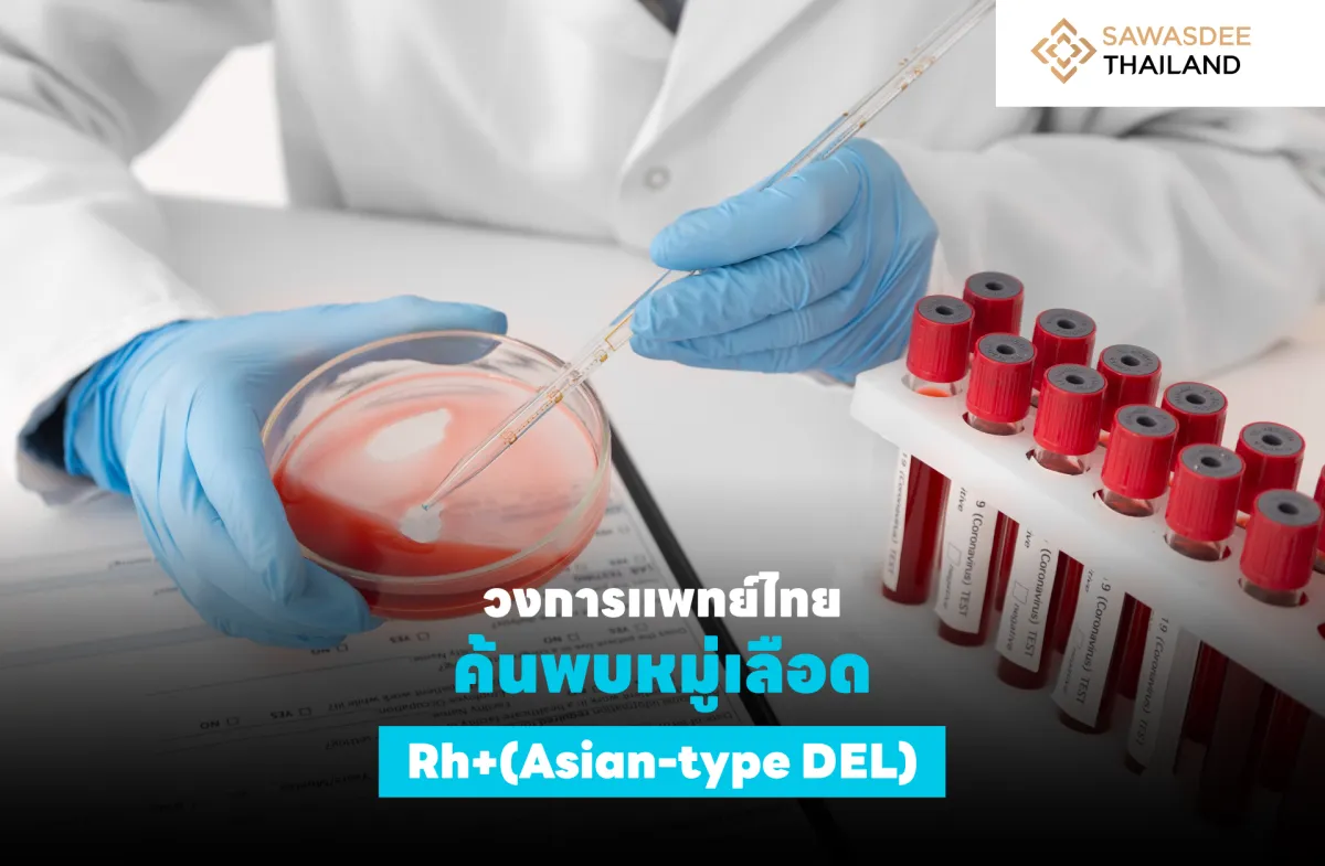 วงการแพทย์ไทย ค้นพบหมู่เลือด Rh+(Asian-type DEL)