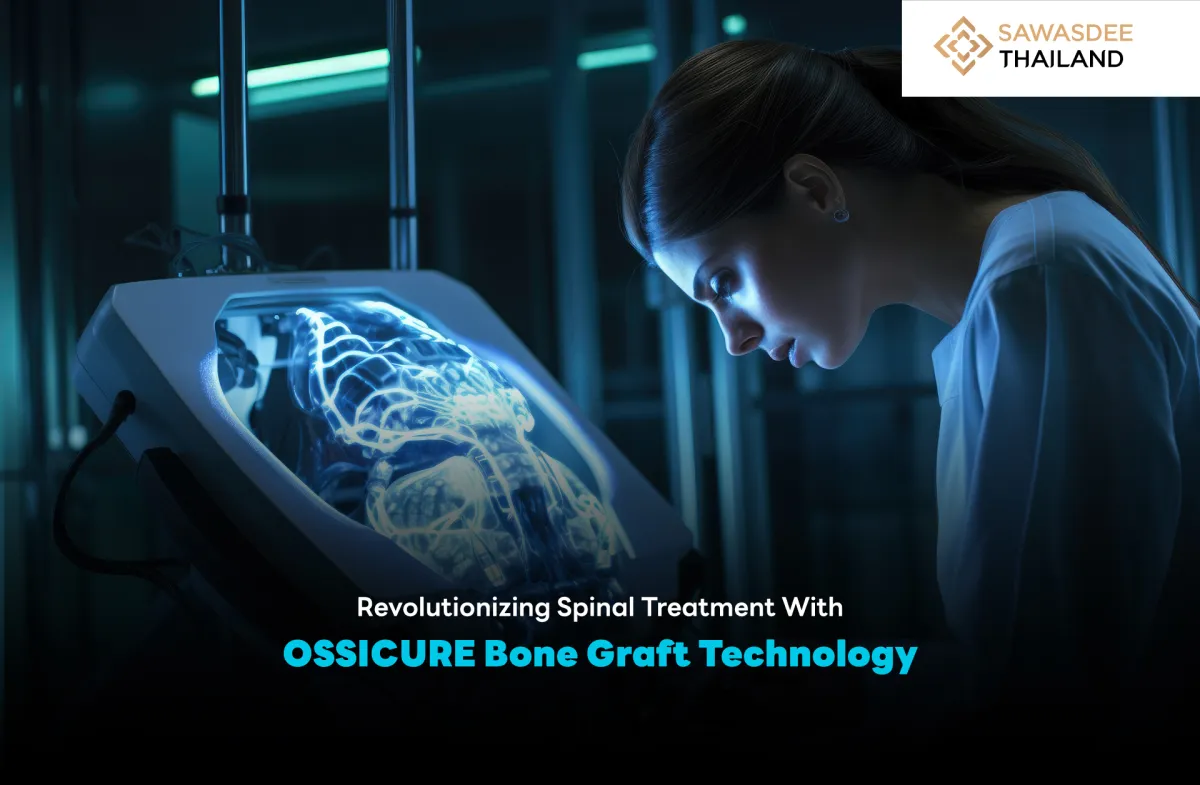 Revolutionizing Spinal Treatment With OSSICURE Bone Graft Technology